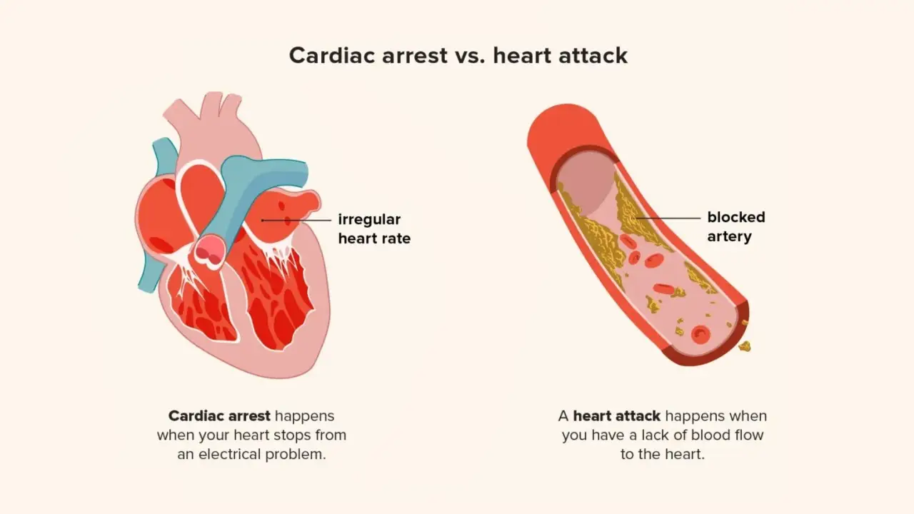 Heart Attack VS Cardiac Arrest