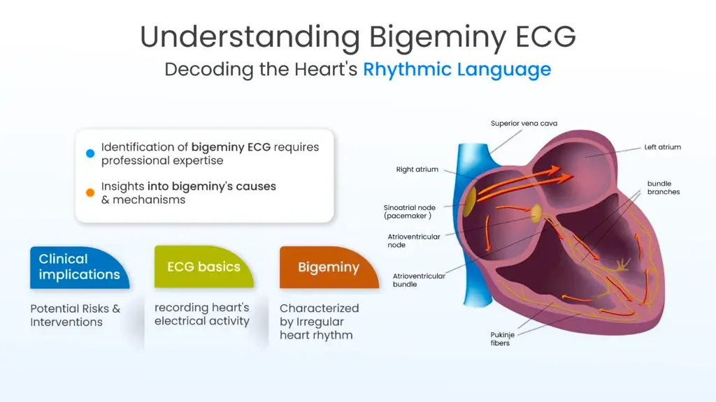 Understanding Bigeminy ECG