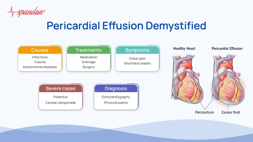 Pericardial Effusion Demystified: Causes, Symptoms, and Solutions
