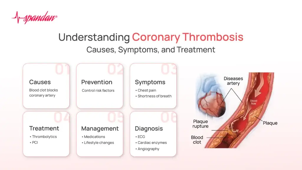 Understanding Coronary Thrombosis: Causes, Symptoms, and Treatment