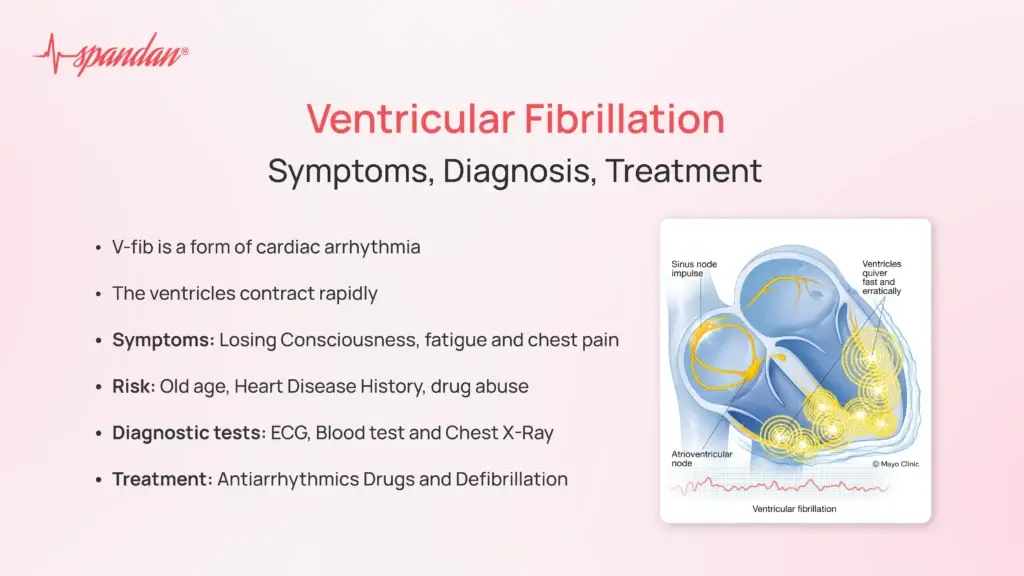 Ventricular Fibrillation: Symptoms, Diagnosis, Treatment