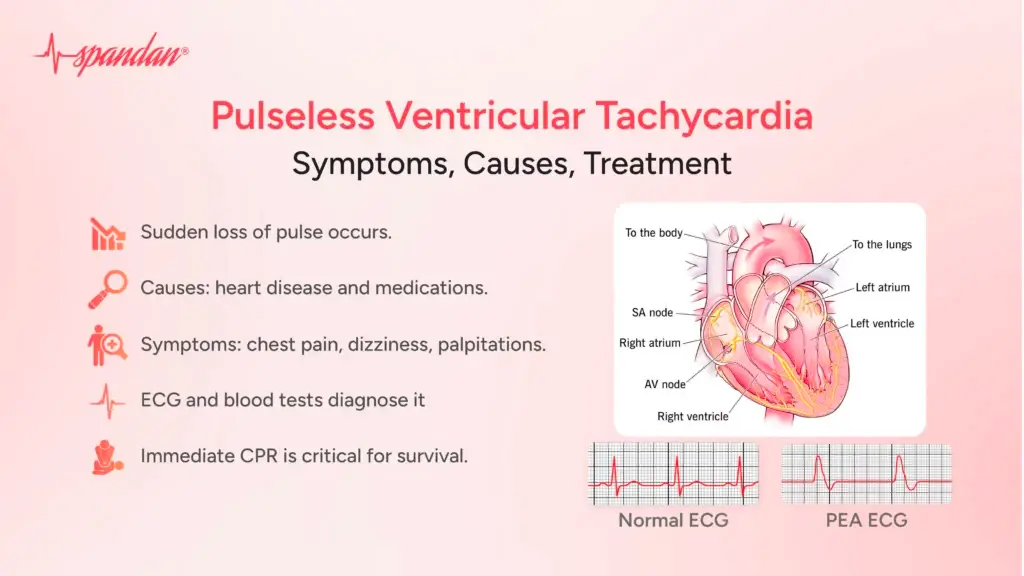 Pulseless Ventricular Tachycardia: Symptoms, Causes, Treatment