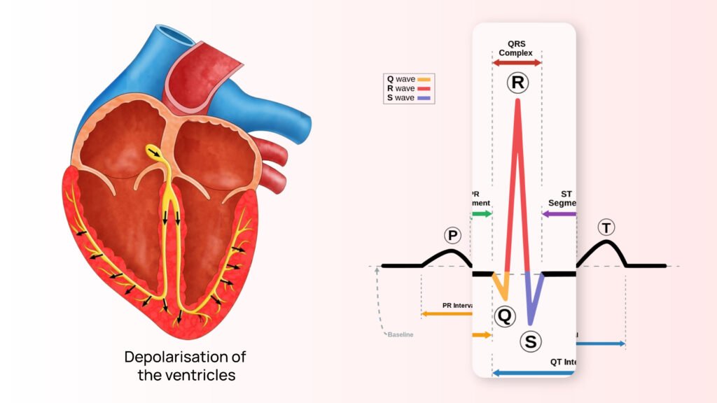 QRS Complex Abnormalities: Clarifying ECG Abnormalities for Heart Health