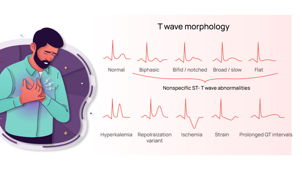 what causes a double t wave