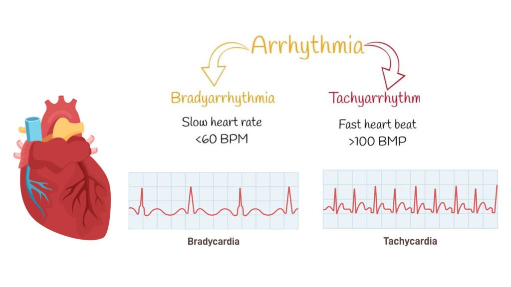 Difference between tachycardia and bradycardia