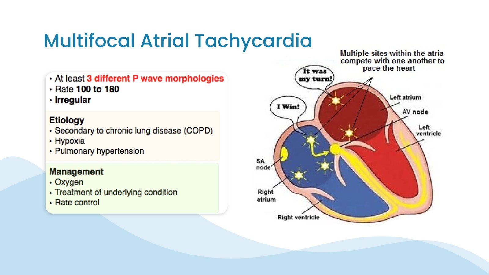 Multifocal Atrial Tachycardia