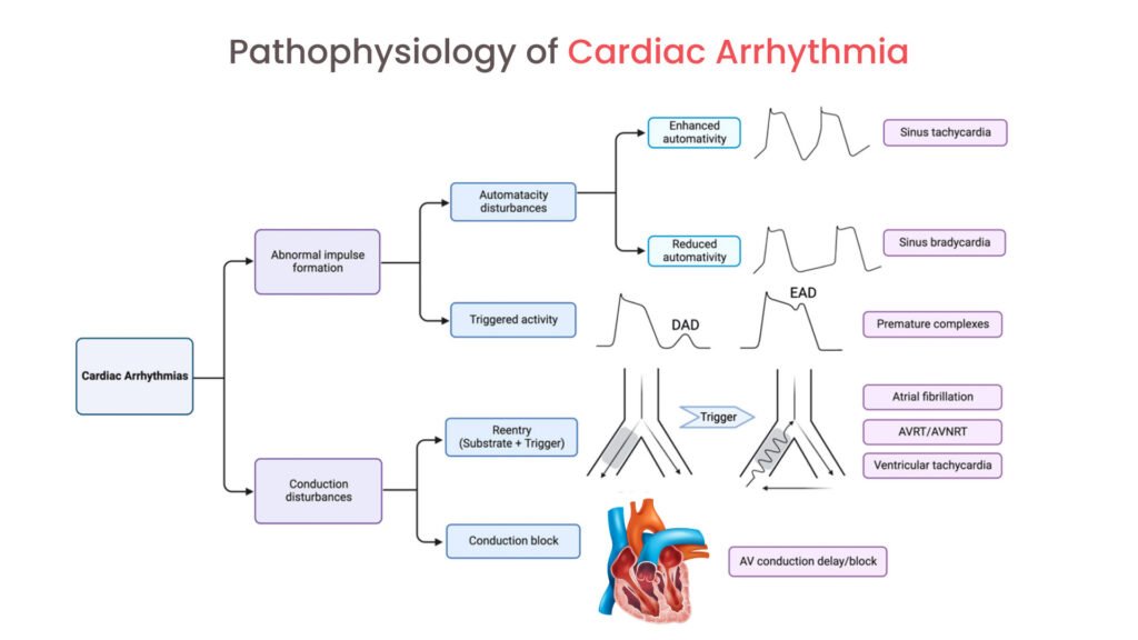Pathophysiology of Cardiac Arrhythmia