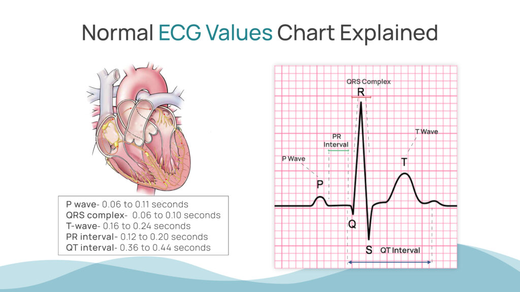 Normal ECG Values Chart Explained - Sunfox Technologies