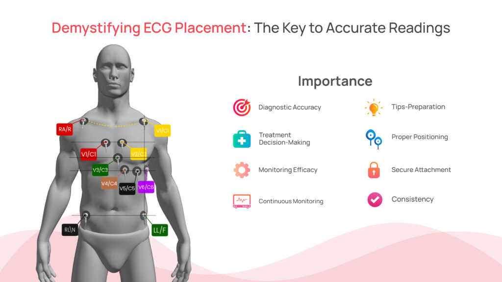 ECG placement