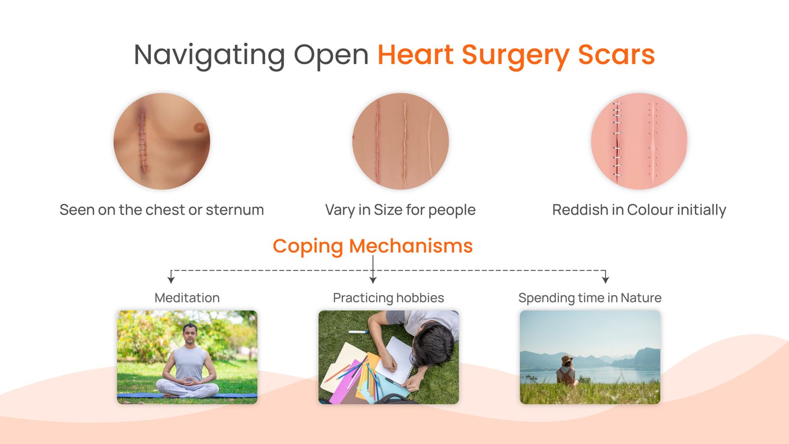 Open heart surgery scars