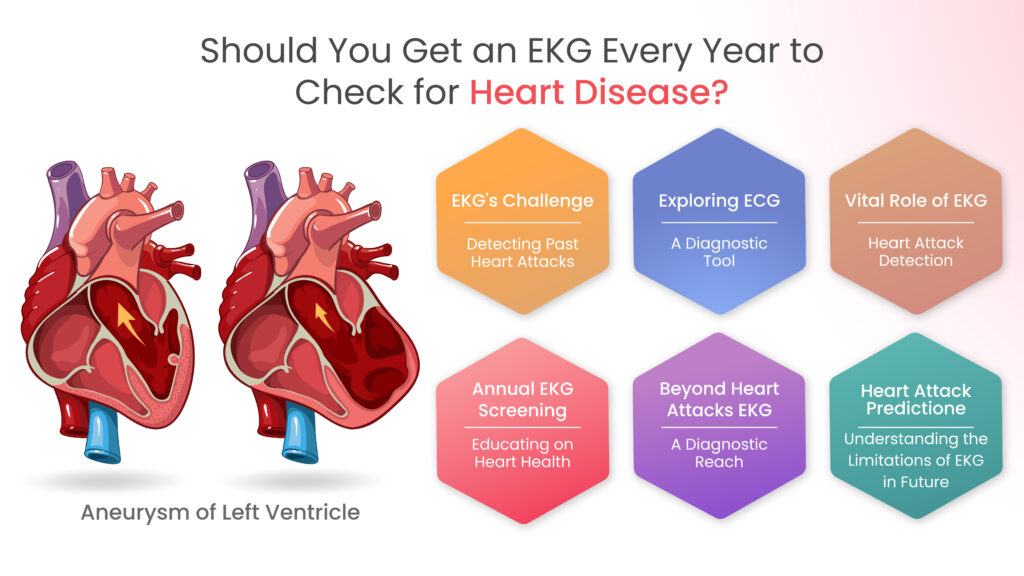 ekg