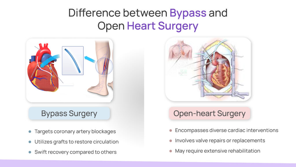 Difference between Bypass and Open Heart Surgery