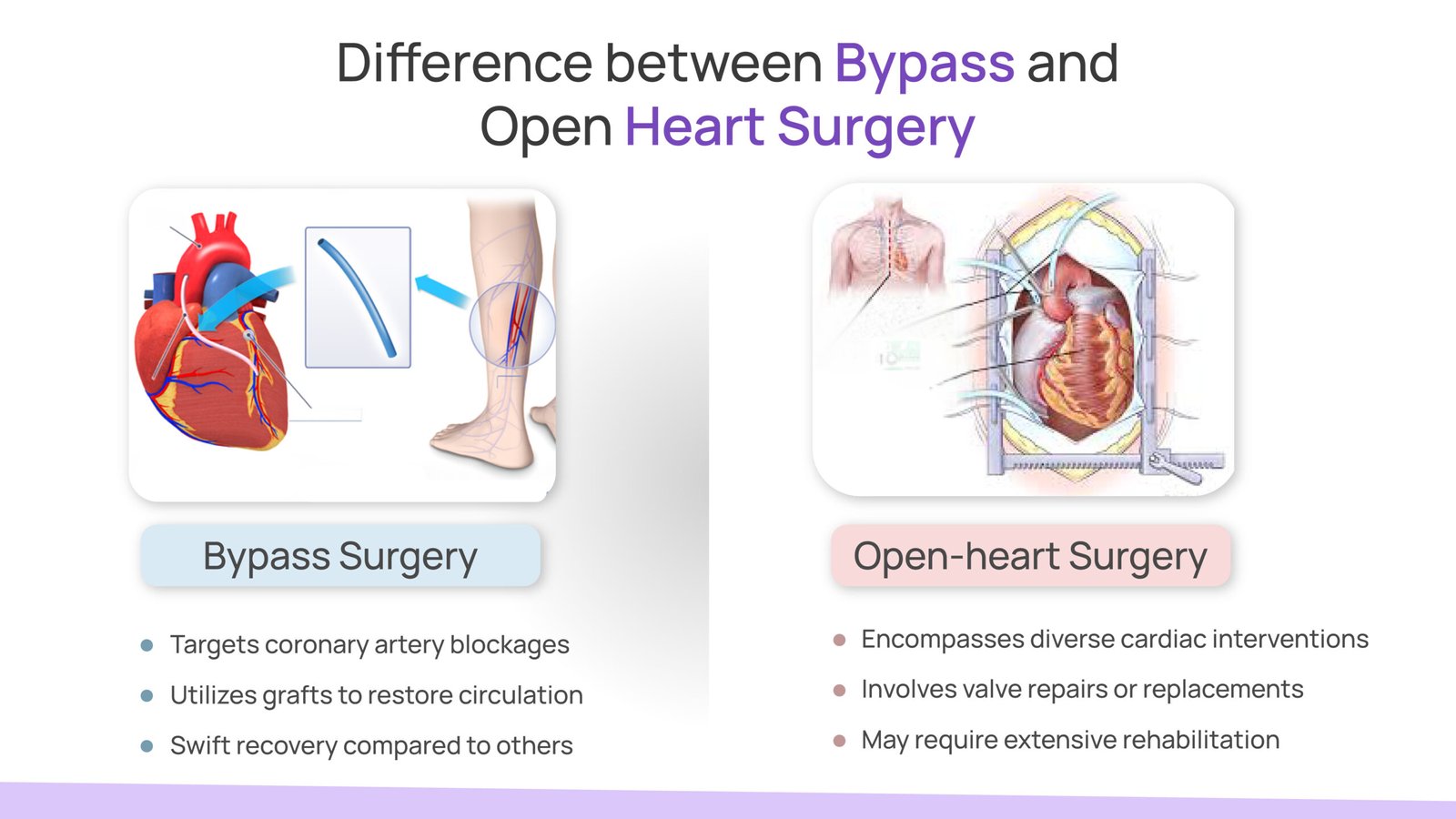 differnce between bypass and open heart surgery
