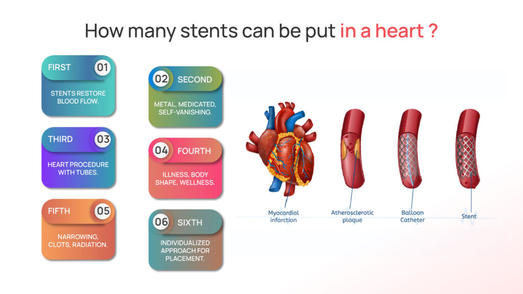 how many stents can be put in a heart