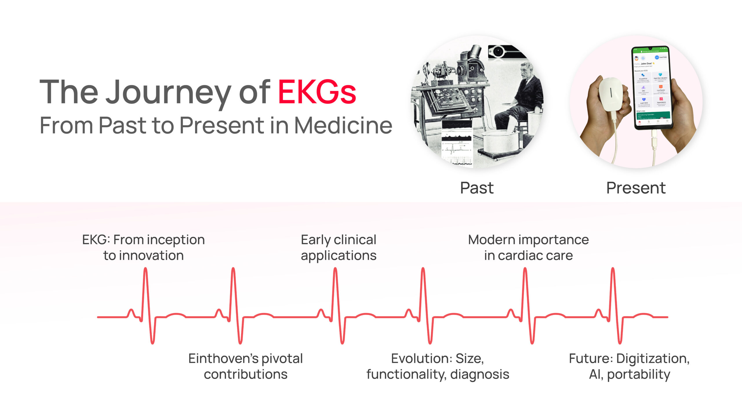 Journey of EKGs