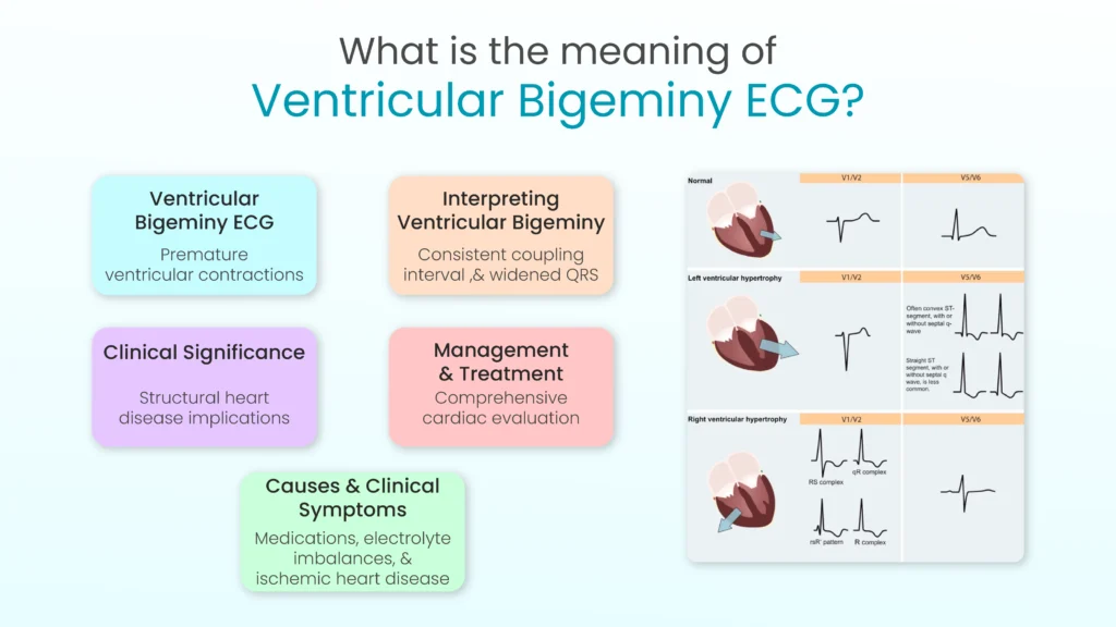 Ventricular Bigeminy ECG: Meaning and Treatment