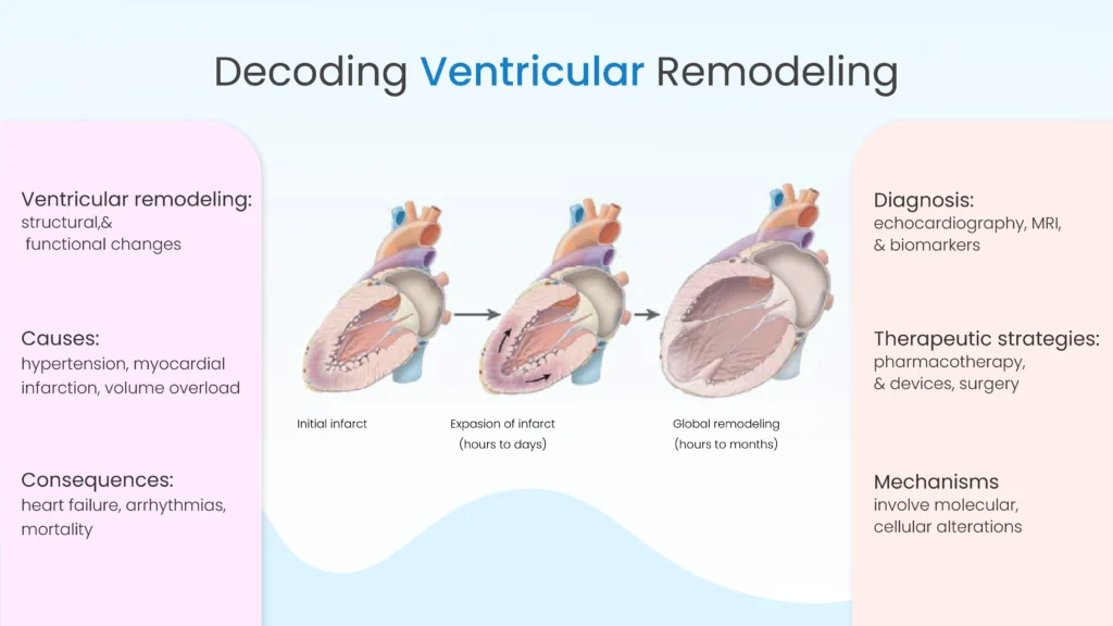 Decoding Ventricular Remodeling