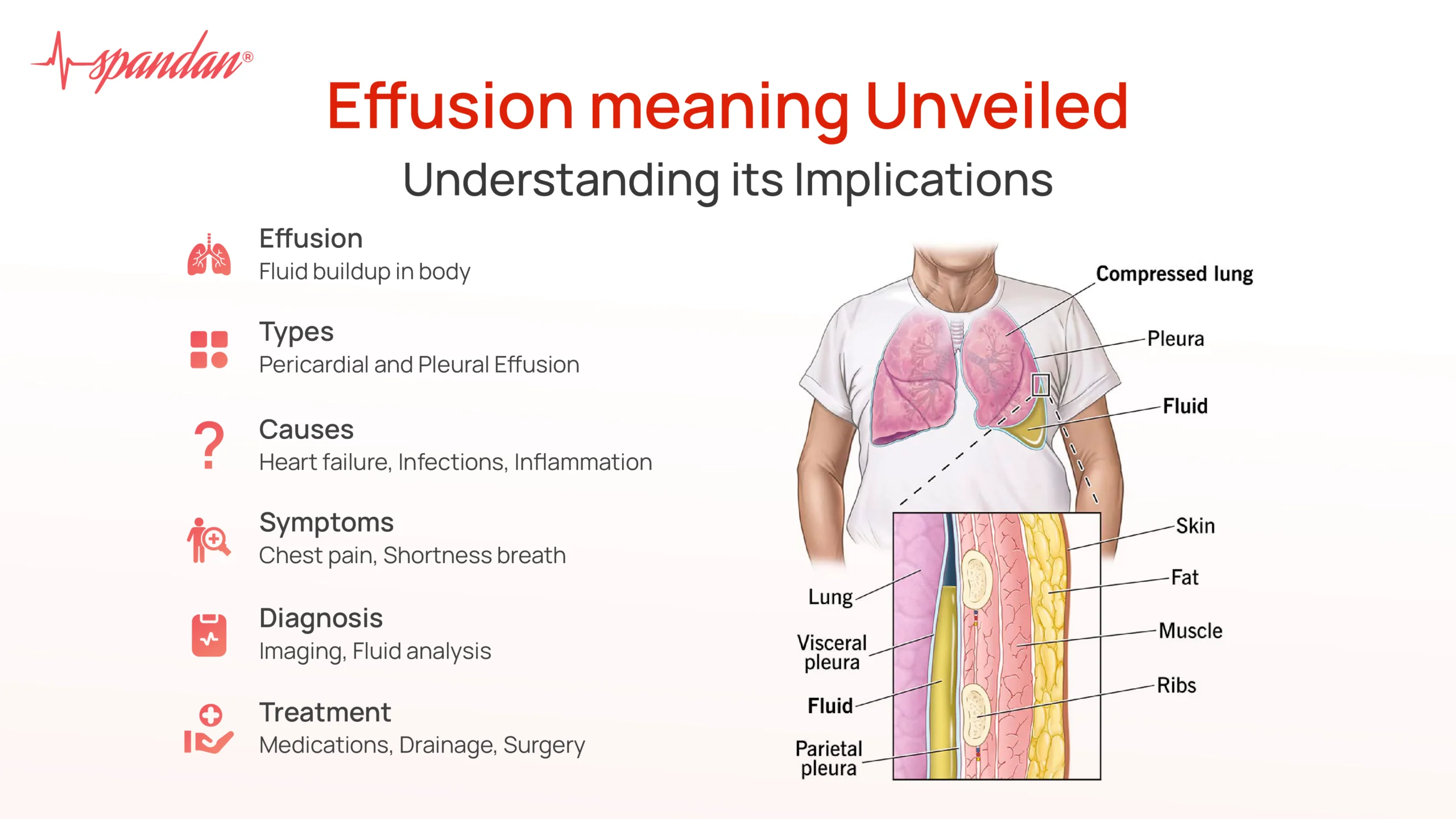 Effusion meaning