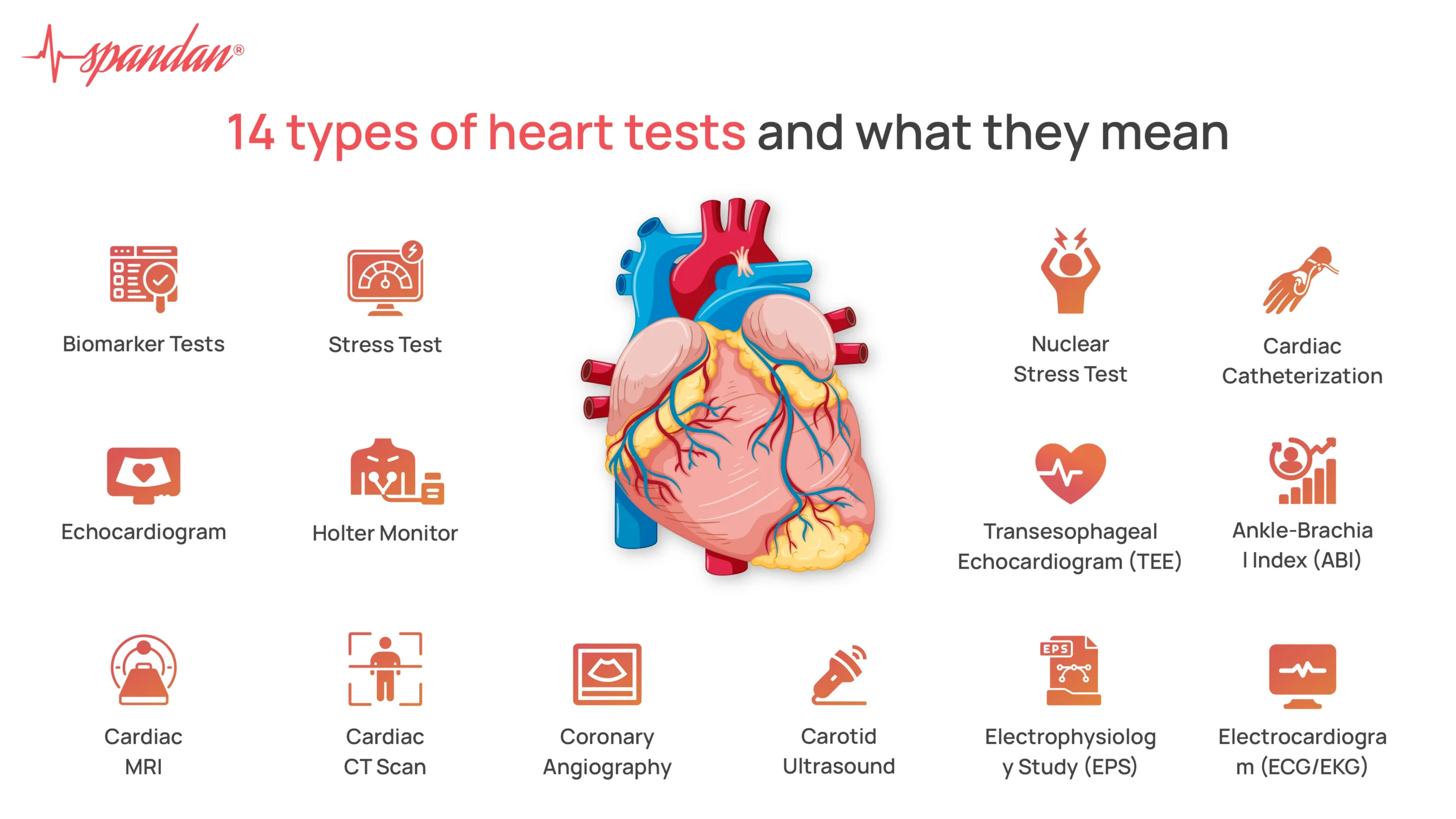 types of heart tests