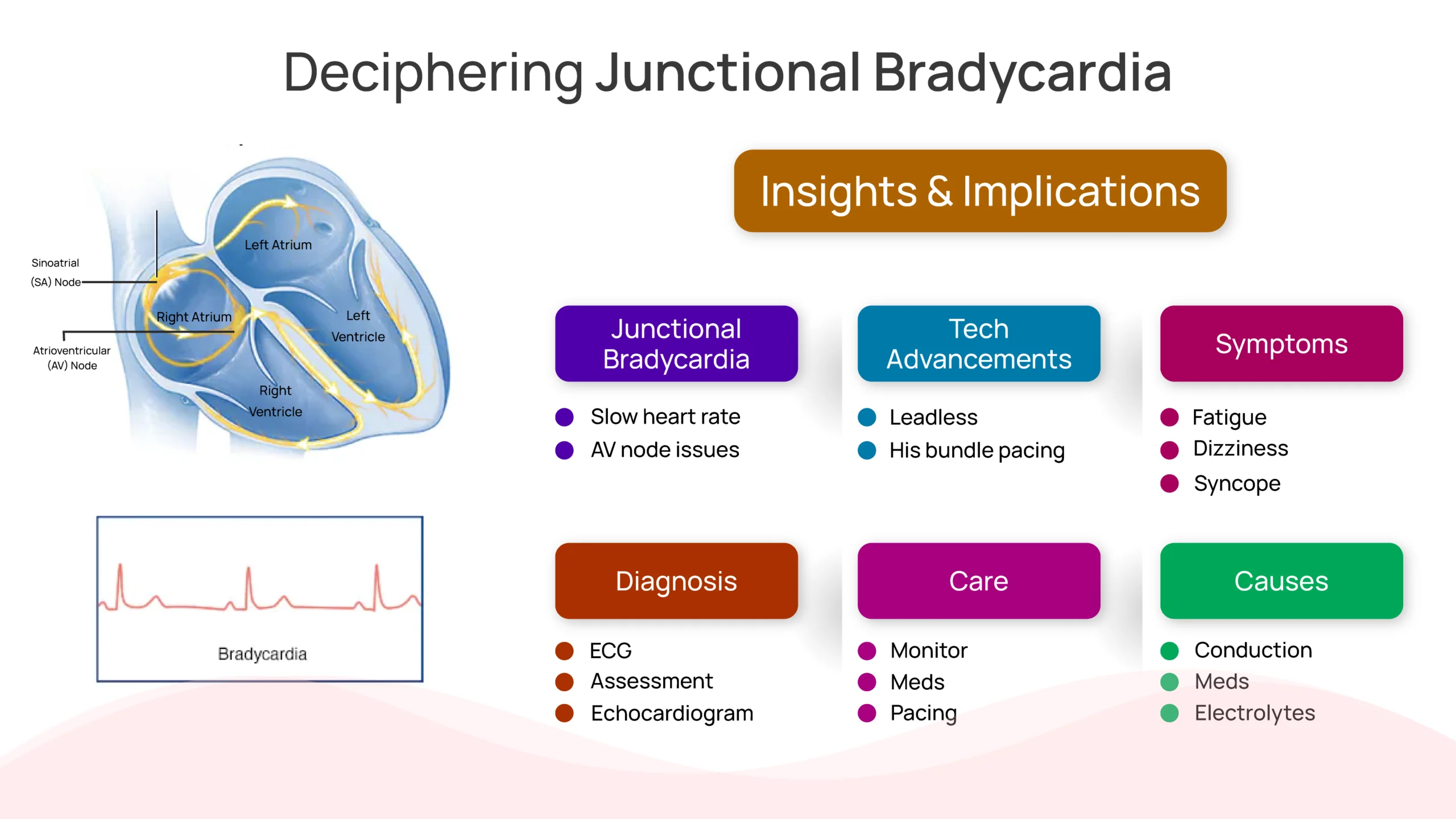 Junctional Bradycardia