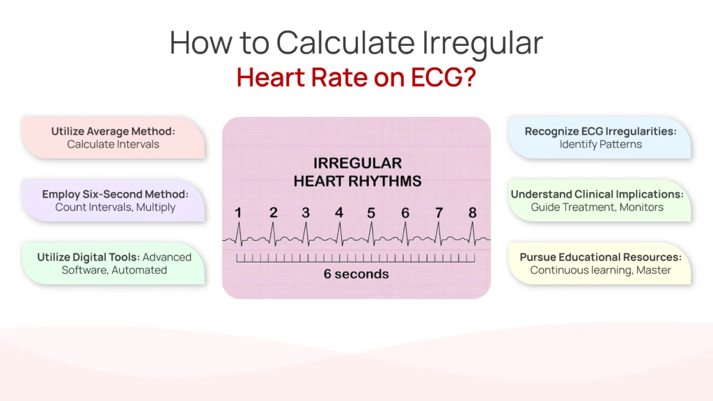 How to Calculate Irregular Heart Rate on ECG?