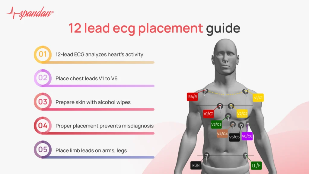 12 lead ecg placement