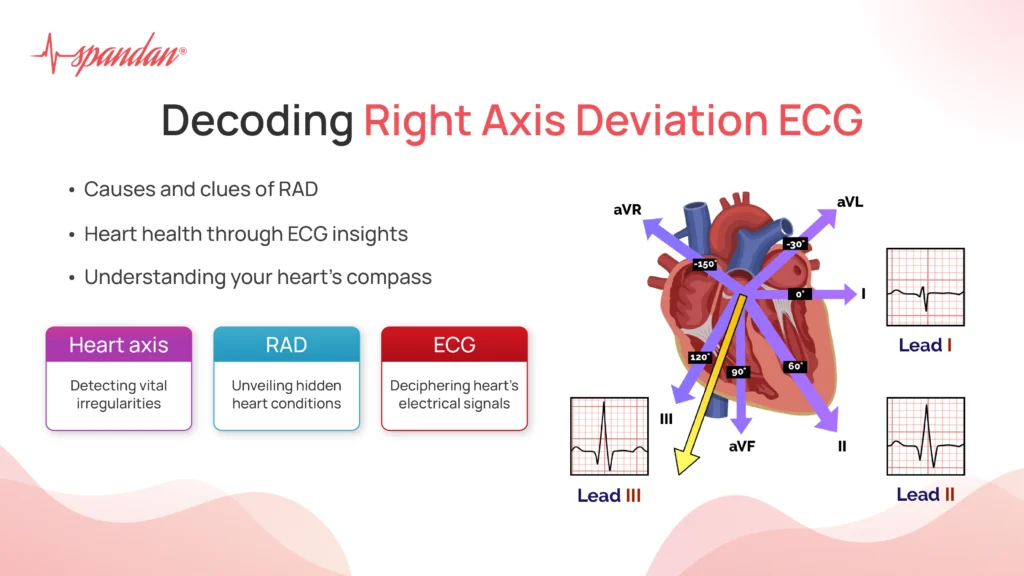 Decoding Right Axis Deviation ECG