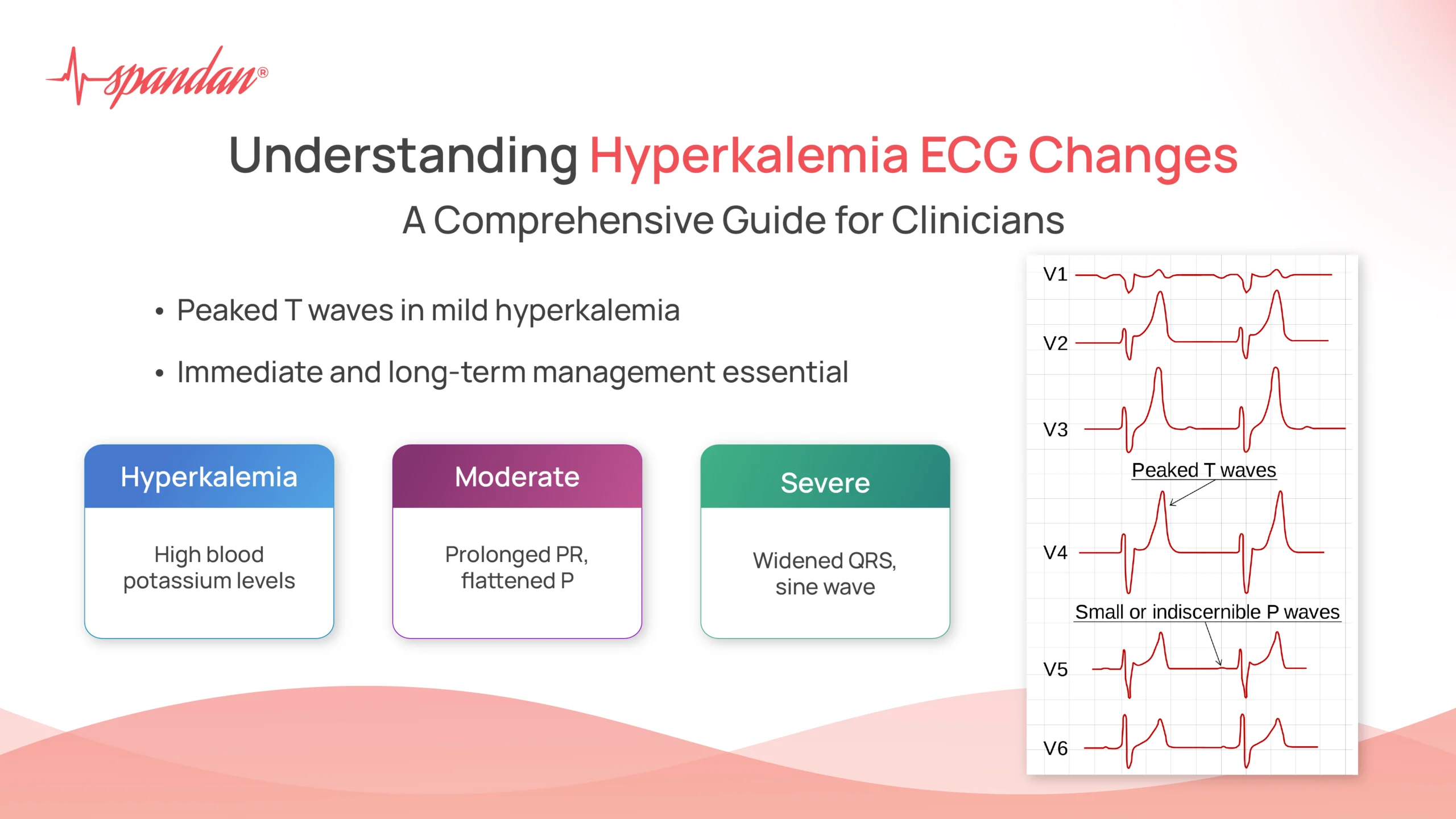 hyperkalemia ecg changes