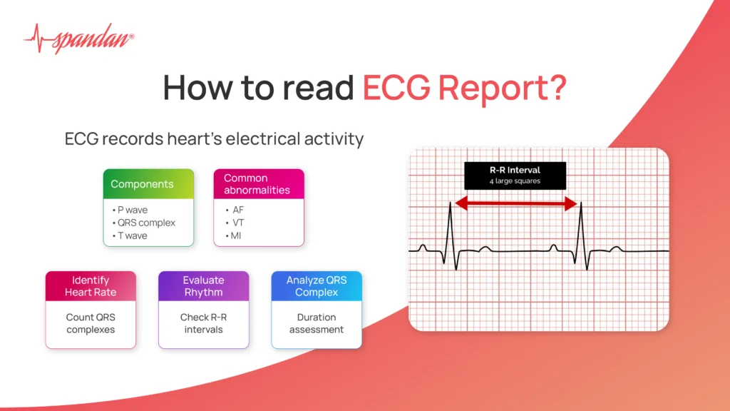 how to read ecg report