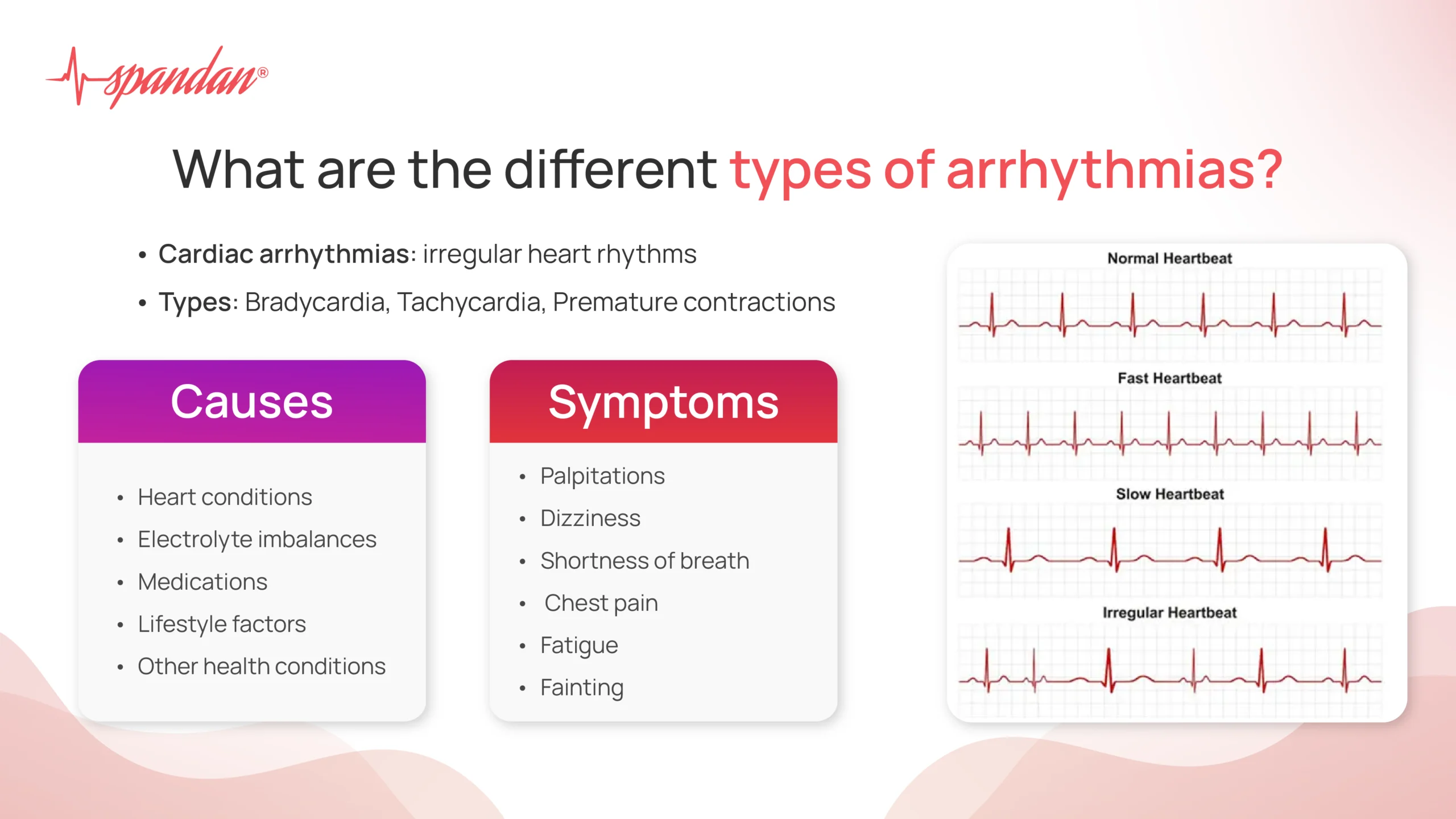 types of arrhythmia