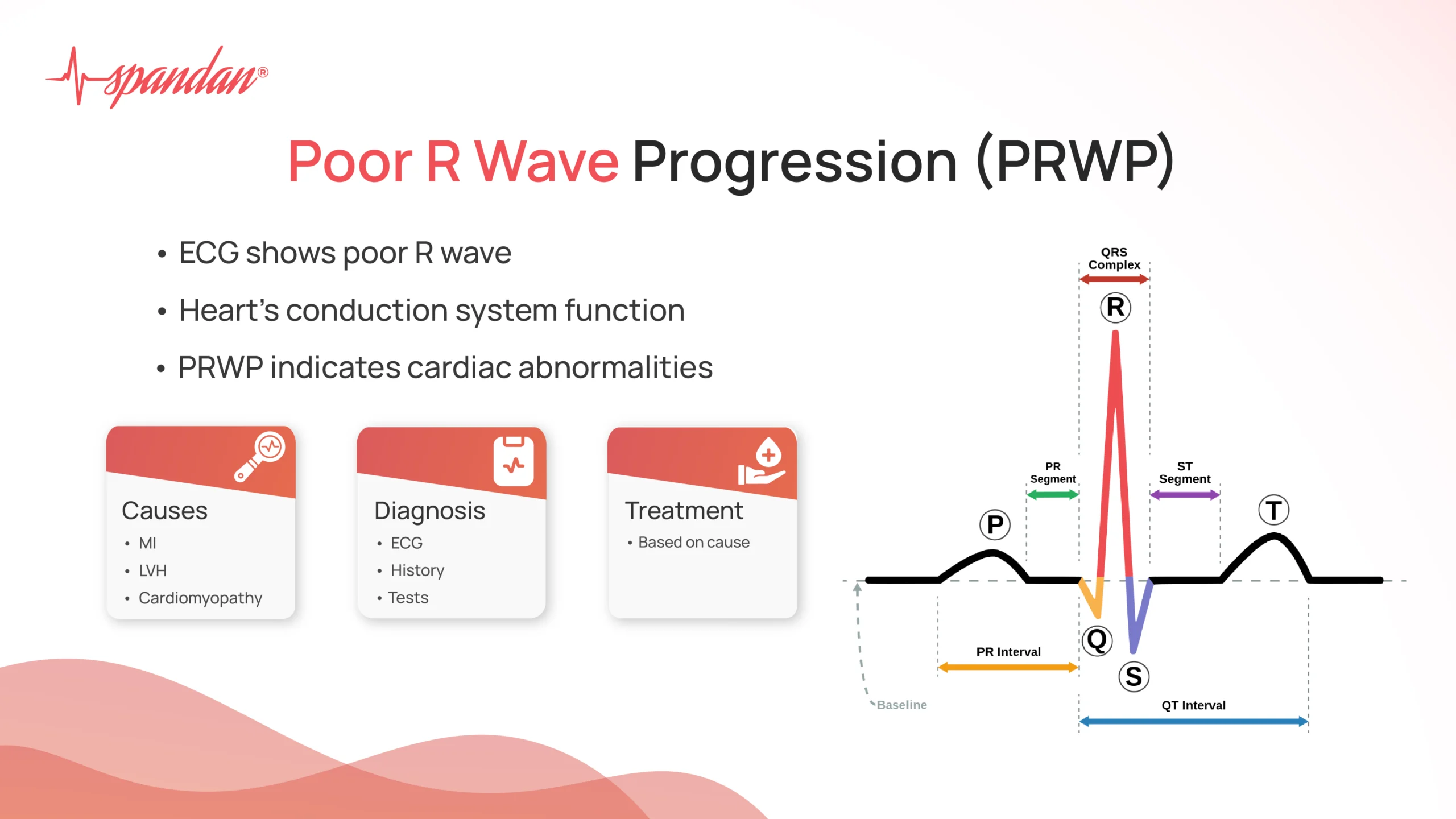 poor r wave progression