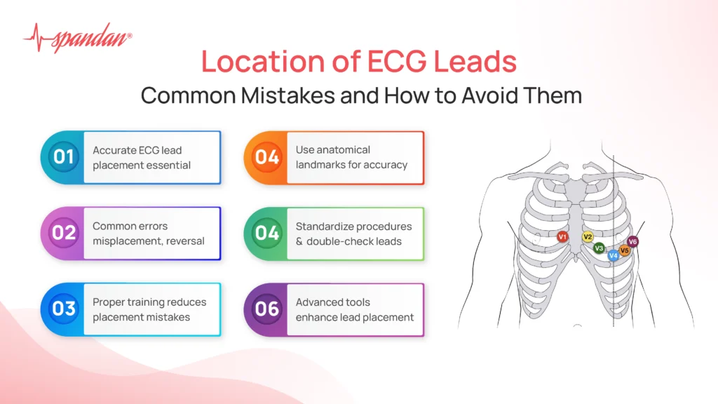 location of ecg leads