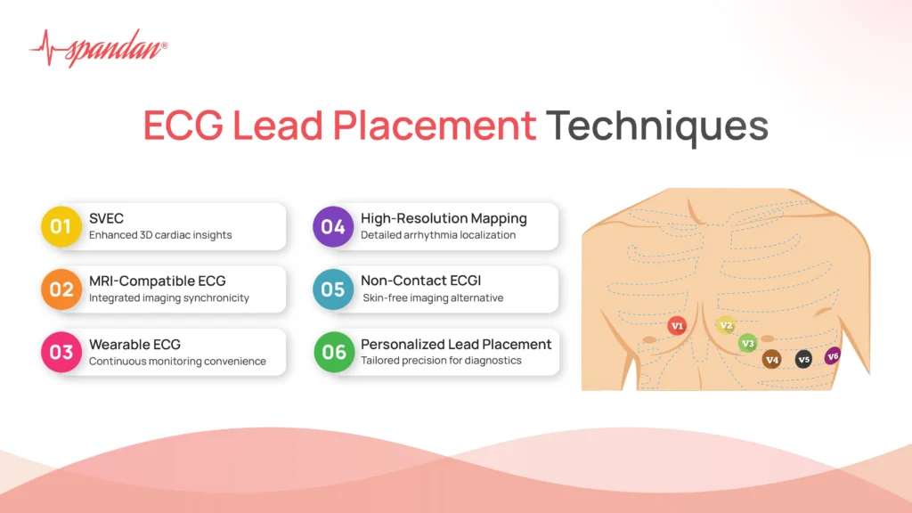 ecg lead placement