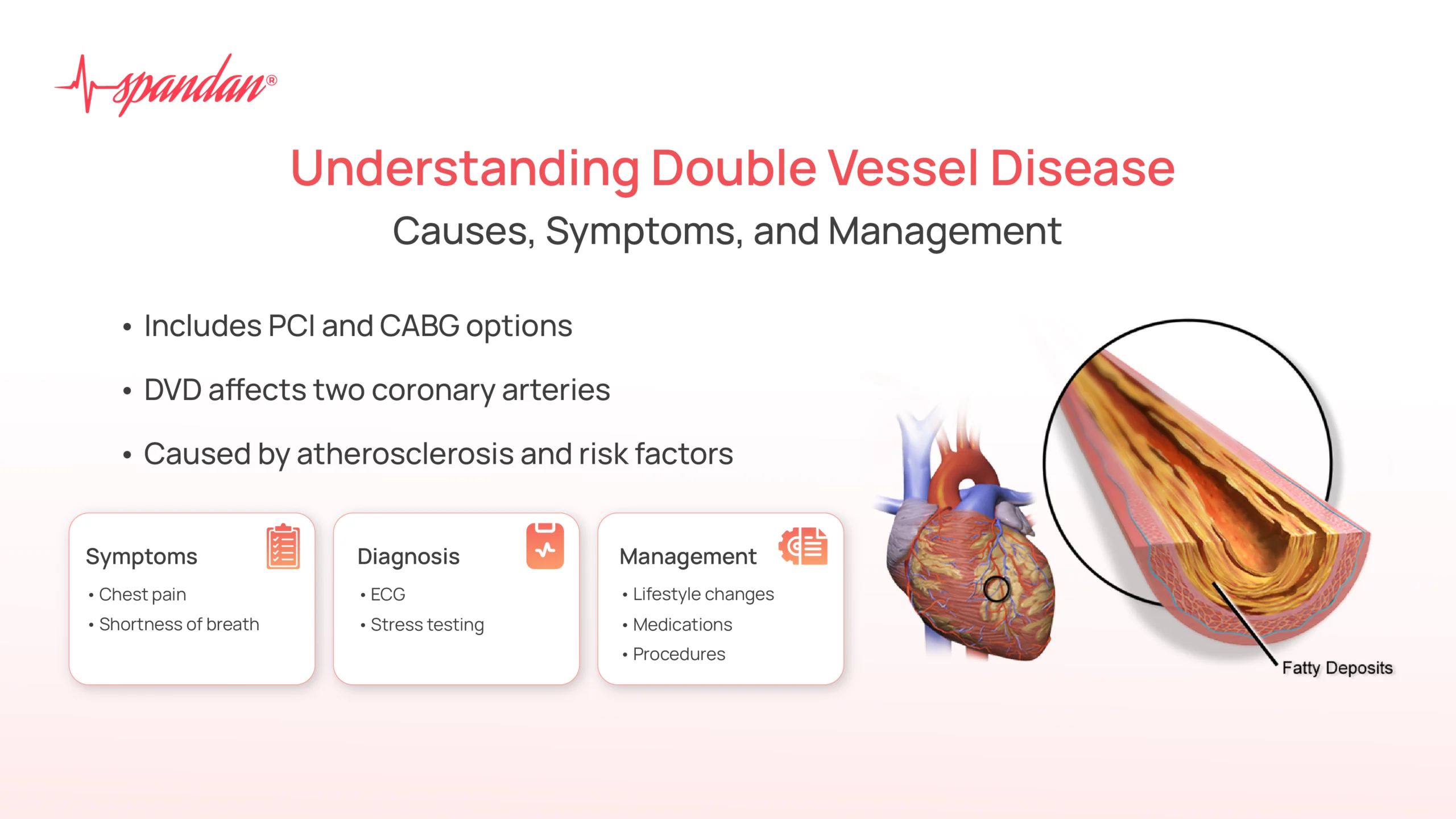 double vessel disease