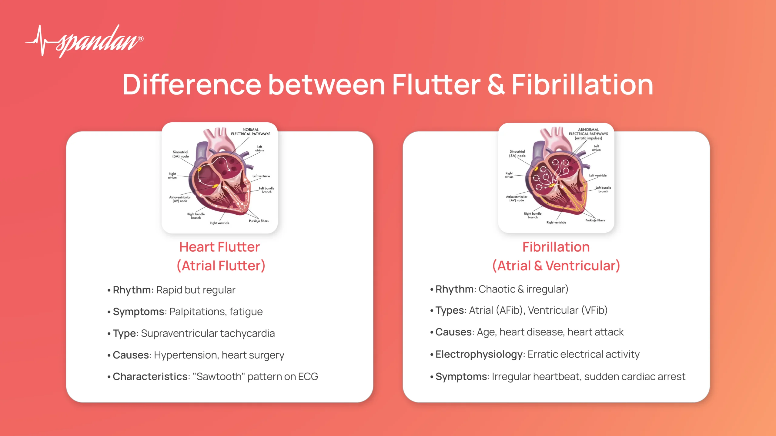 difference between flutter and fibrillation