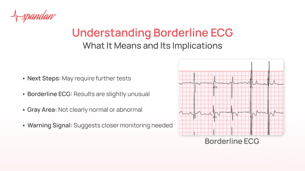 borderline ecg