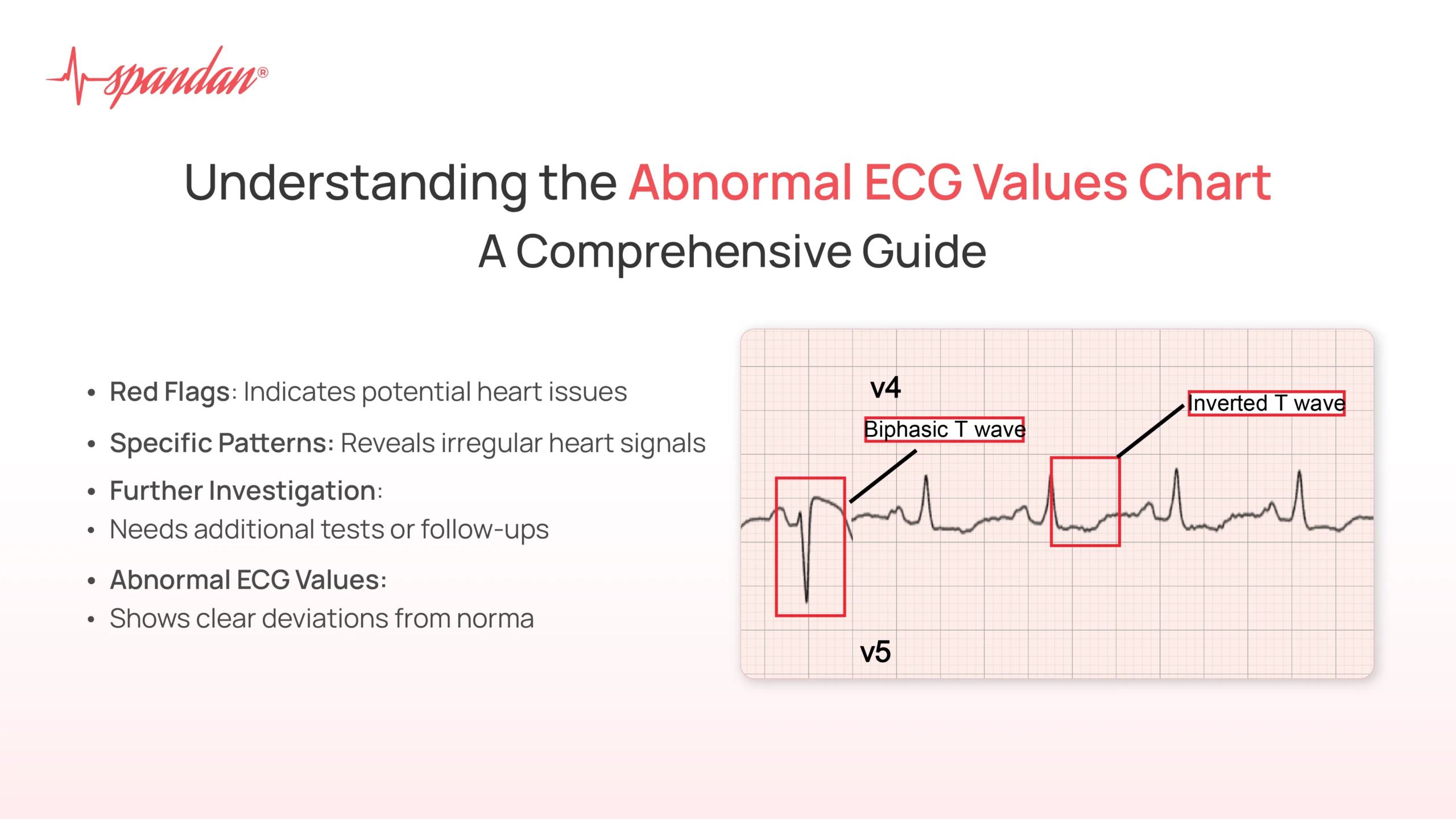 Abnormal ECG Values Chart