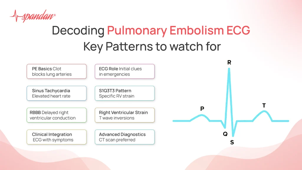 Decoding Pulmonary Embolism ECG: Key Patterns to Watch For