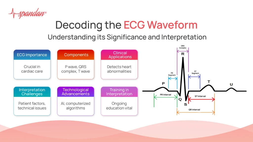 ecg waveform