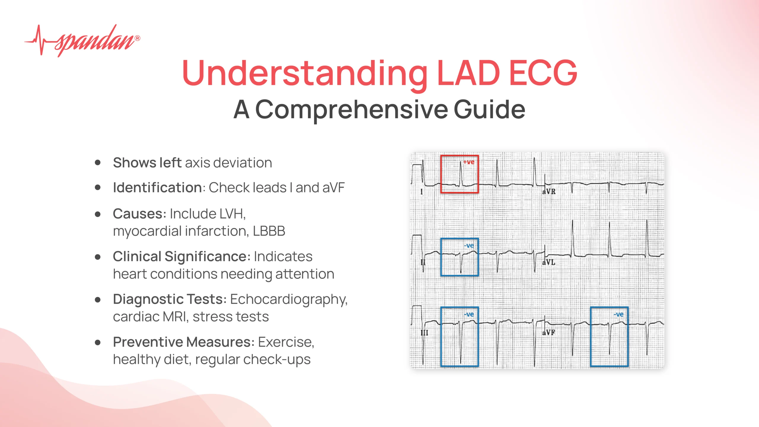 lad ecg