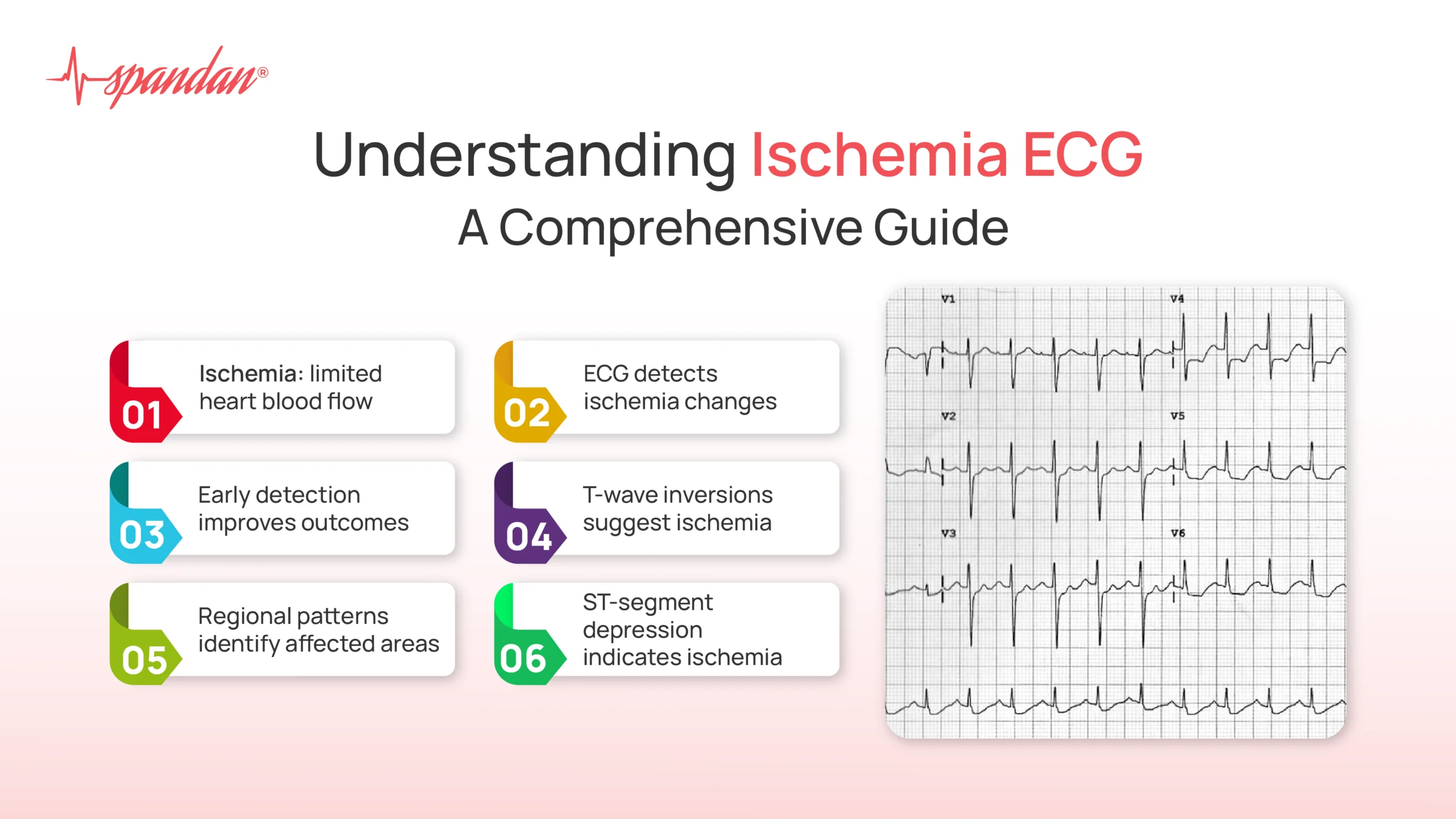 ischemia ecg