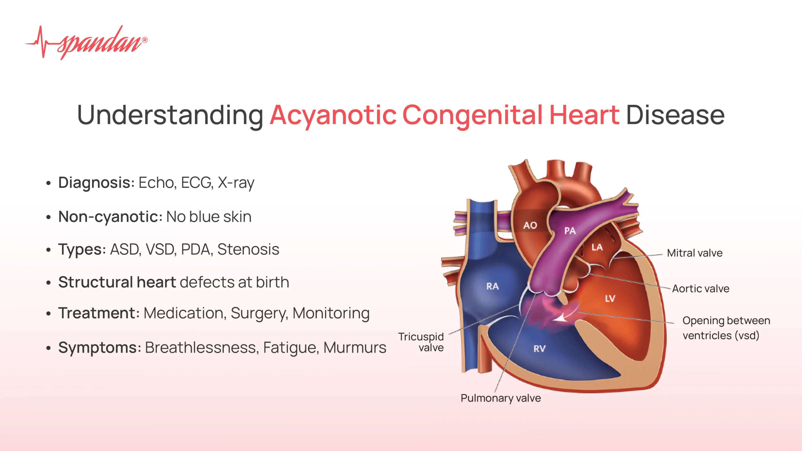 acyanotic congenital heart disease