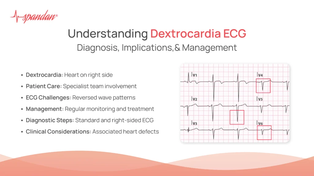 Dextrocardia ECG: Diagnosis, Implications, & Management