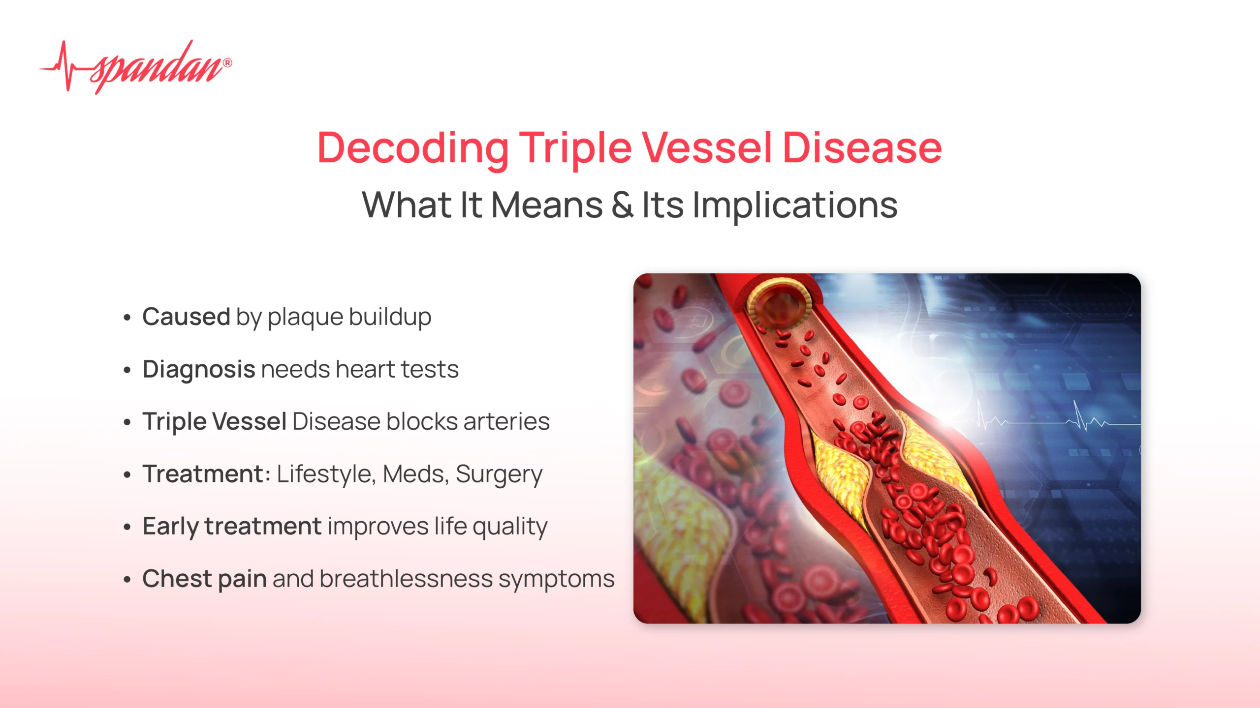 triple vessel disease