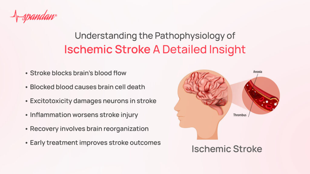pathophysiology of ischemic stroke