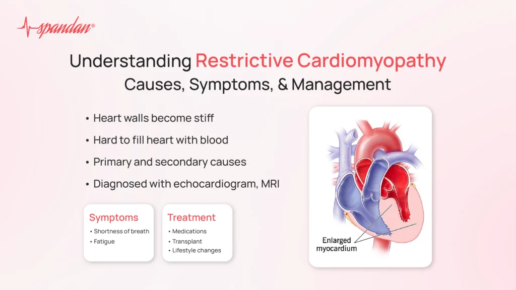 restrictive cardiomyopathy