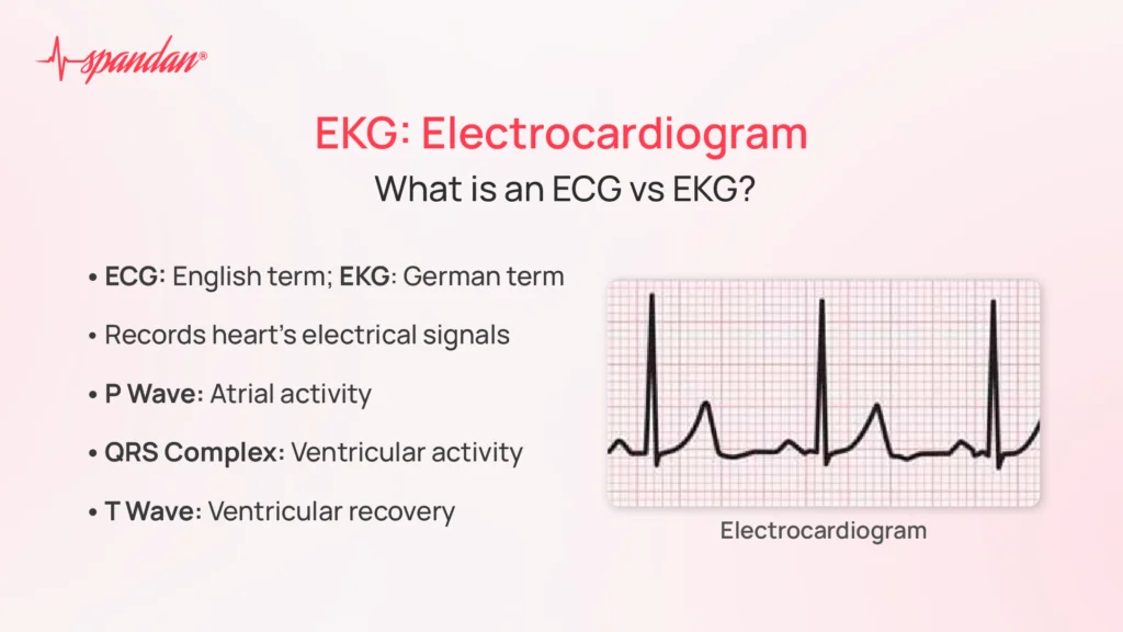 ekg