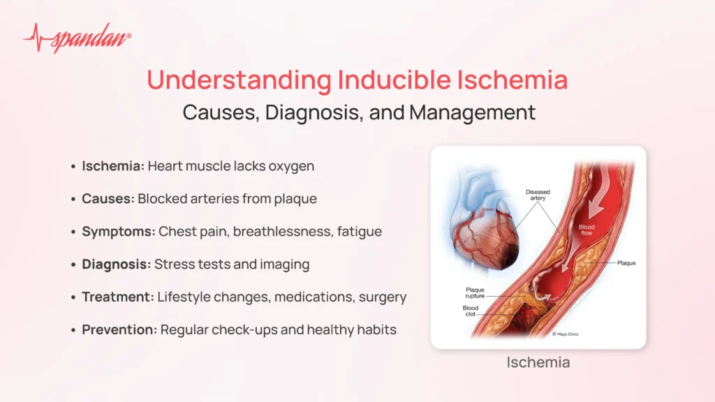 inducible ischemia