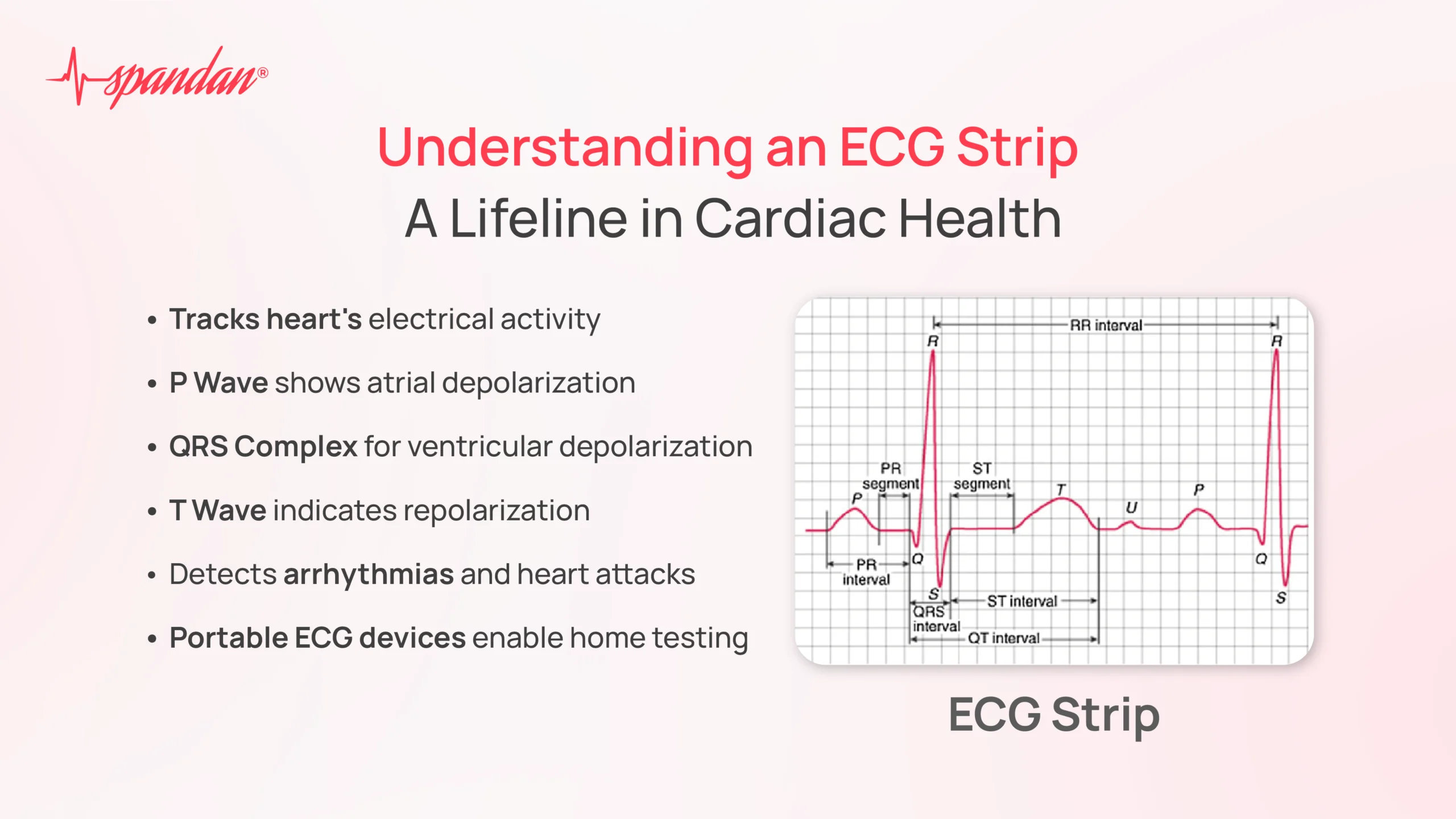 ecg strips