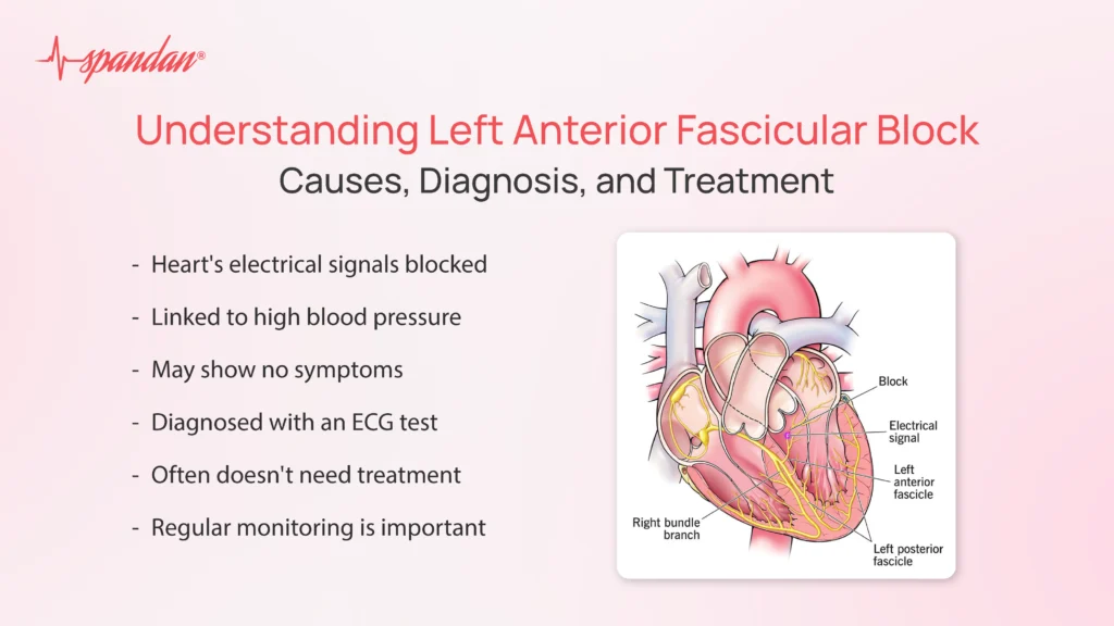 left anterior fascicular block